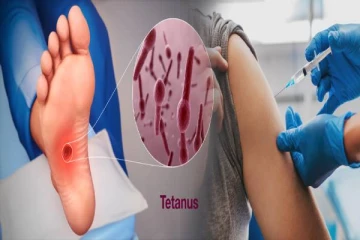tetanus symptoms: டெட்டனஸ் வராமல் தடுப்பது எப்படி? அறிகுறிகள் எப்படியிருக்கும்