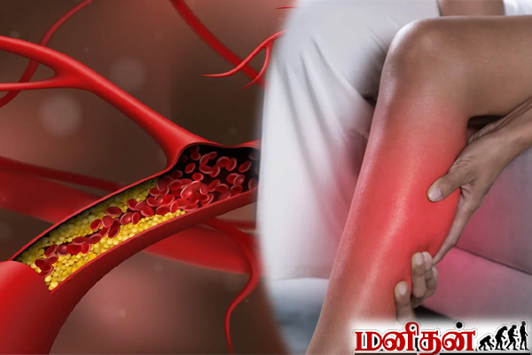 அடிக்கடி கால் வலி, தசை பிடிப்பு ஏற்படுகின்றதா? இந்த உணவை நிறுத்திக்கோங்க | Heavy Leg Pain Reason High Cholestrol அடிக்கடி கால் வலி, தசை பிடிப்பு ஏற்படுகின்றதா? இந்த உணவை நிறுத்திக்கோங்க | Heavy Leg Pain Reason High Cholestrol
