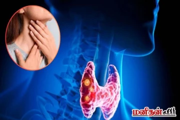 அலட்சியப்படுத்தவே கூடாத தைராய்டு புற்றுநோயின் ஆரம்ப அறிகுறிகள்!