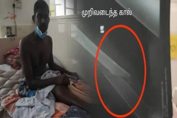 முல்லைத்தீவில் மாற்றுத்திறனாளி மீது மூர்க்கத்தனமான தாக்குதல் (PHOTOS)