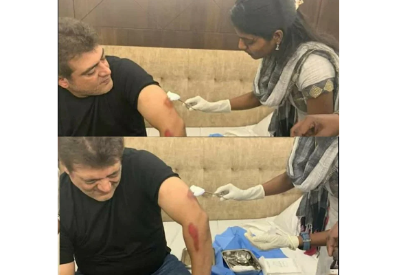 ரத்தக் காயத்துடன் வெளியான அஜீத்தின் புகைப்படம் - ஷாக்கான ரசிகர்கள் - வைரலாகும் புகைப்படம் | Actor Ajith Bloody Wound Viral Photos