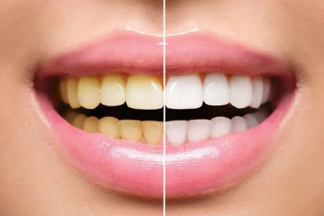 இரவில் பல துலக்குவதால் இவ்வளவு நன்மைகள் கிடைக்குதா? தினமும் இதை செய்து பாருங்க