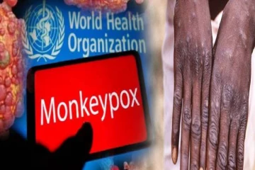 வேகமாக பரவி வரும் ஆபத்தான Mpox வைரஸ்.... முக்கிய அறிகுறிகள் என்னென்ன தெரியுமா?