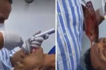 தூண்டில் போட்டு பிடித்த இளைஞரை நொடியில் பலி வாங்கிய மீன்! அடுத்த நொடியே காத்திருந்த அதிர்ச்சி : விழிப்பிதுங்கி போன மருத்துவர்கள்