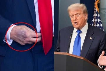 நான் தினமும் 325 mg ஆஸ்பிரின் எடுத்துக் கொள்கிறேன்! உடல்நிலை குறித்து டிரம்ப் பேட்டி