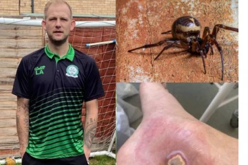 காலில் ஏற்பட்ட கொப்பளத்தை சாதாரணமாக எடுத்து கொண்ட இளைஞன்! பரிசோதனையில் காத்திருந்த அதிர்ச்சி... எச்சரிக்கை செய்தி