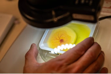 புற்று நோய்க்கு புதிய சிகிச்சை முறையை கண்டு பிடித்த கனடிய ஆய்வாளர்கள்