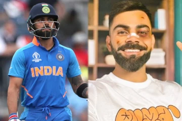 விபத்தில் சிக்கிய விராட் கோலி..? முகத்தில் காயங்களுடன் புகைப்படம் - அதிர்ச்சியடைந்த ரசிகர்கள்!