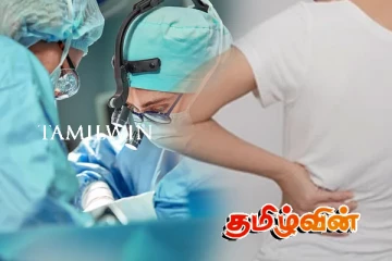 பெண்ணின் கருப்பையில் இருந்து அகற்றப்பட்ட 10 கிலோகிராம் நீர்க்கட்டி