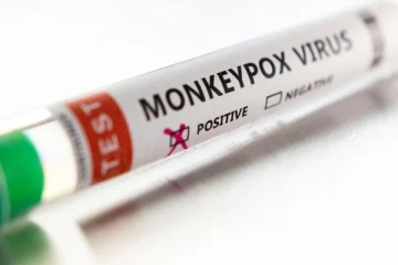 இலங்கையிலும் குரங்குக் காய்ச்சல்..! நாட்டு மக்களுக்கு வழங்கப்பட்டுள்ள அவசர அறிவுறுத்தல்