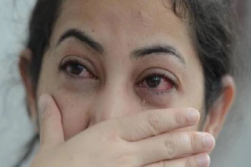 ‘மெட்ராஸ் ஐ’ பாதிப்பு அதிகரிப்பு; அறிகுறிகள் இதுதான் - மக்களே உஷார்