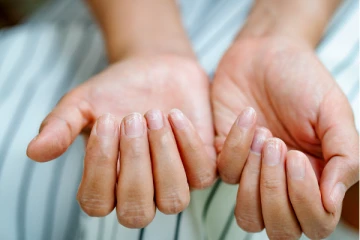 காரணம் இல்லாமல் நகம் வீக்கமா இருக்கா? இந்த ஆபத்து வரப்போகுதுனு அர்த்தமாம்...எச்சரிக்கை!