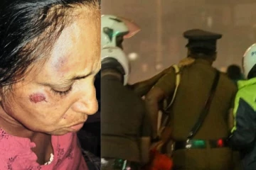 தாயை கொடூரமாக தாக்கிய மகன், மருமகள் - காயங்களுடன் மீட்ட பொலிஸார்