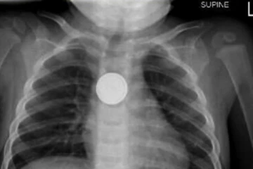 දෙමාපියන්ට යළි අනතුරු ඇඟවීමක්...