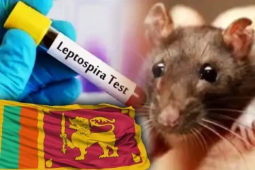 தீவிரமடையும் எலிக்காய்ச்சல் ; பொதுமக்களுக்கு வைத்தியர் விடுத்துள்ள எச்சரிக்கை