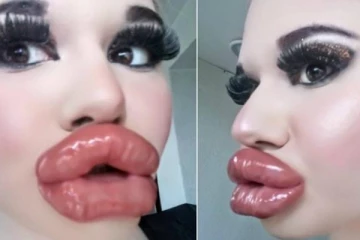 ලෝකයේ විශාලතම තොල් ඇති සුරූපි යුවතියකගේ අමුතු ආසාව - පියයුරු විශාල කිරිමේ ශල්‍යකර්මයත් කරලා.. (PHOTOS)