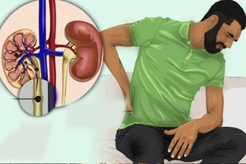 உங்களுக்கு இந்த அறிகுறி எல்லாம் இருந்தால் சிறுநீரக கல் பிரச்சினையாக தான் இருக்குமாம்!  உஷாரா இருங்க