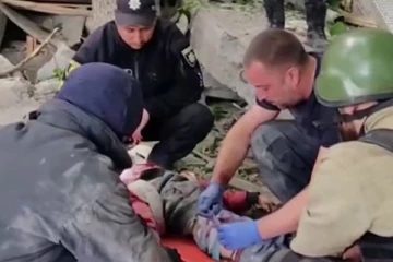 ரஷ்ய படைகள் தாக்குதலால் 9 வயது சிறுவனுக்கு நேர்ந்த நிலை!