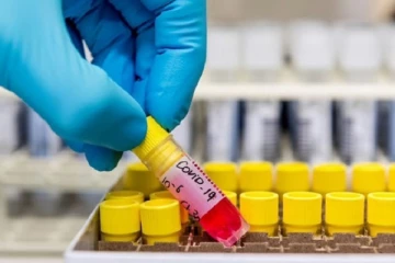 மட்டக்களப்பு பொலிஸ் நிலைய உதவி பொறுப்பதிகாரிக்கு கோவிட் தொற்று உறுதி