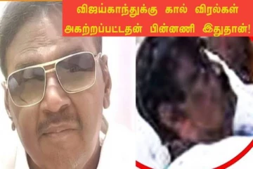 நடிகர் விஜயகாந்தின் கால் விரல்கள் அகற்றப்பட்டதற்கு உண்மை காரணம்! நீரிழிவு நோயாளிகளே எச்சரிக்கை!