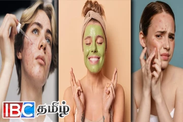 முகப்பருவினால் அவதியா ! நிரந்தர தீர்வுக்கு இந்த ஃபேஸ் மாஸ்க்கை டிரை பண்ணுங்க