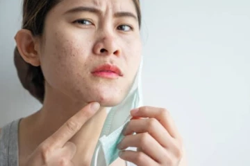 முகக்கவசத்தினால் உண்டாகும்  அலர்ஜியை எப்படி தடுக்கலாம்?