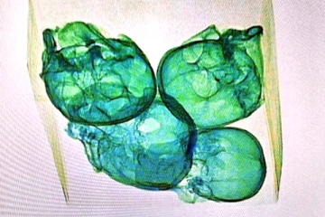 கூரியர் பார்சலில் மண்டை ஓடுகள்; விமான நிலைய சோதனையில் கண்டுபிடிப்பு