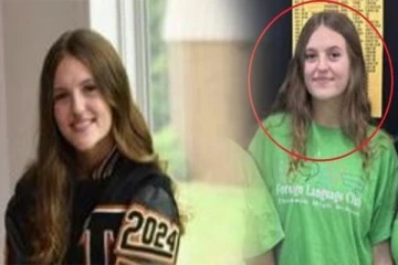 மூக்கு வழியாக மூளைக்குள் நுழையும் கொடிய நோய்க்கிருமி: அழகிய இளம்பெண்ணுக்கு நேர்ந்த பரிதாபம்