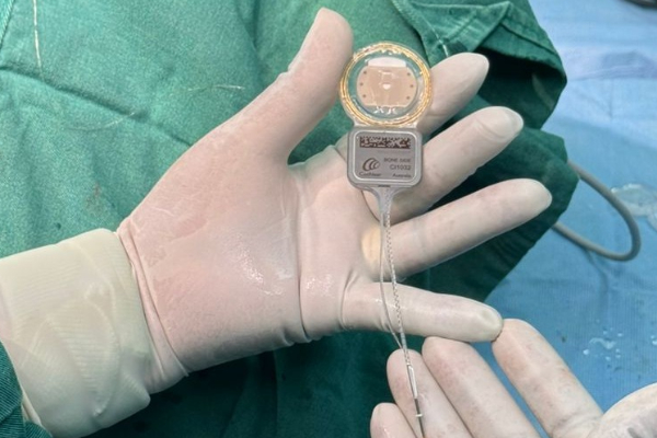 சுகாதார பராமரிப்பில் முக்கிய மைல்கல்: இலங்கைக்கு கிடைத்த அங்கீகாரம் | South Asia S First Smart Hearing Implant