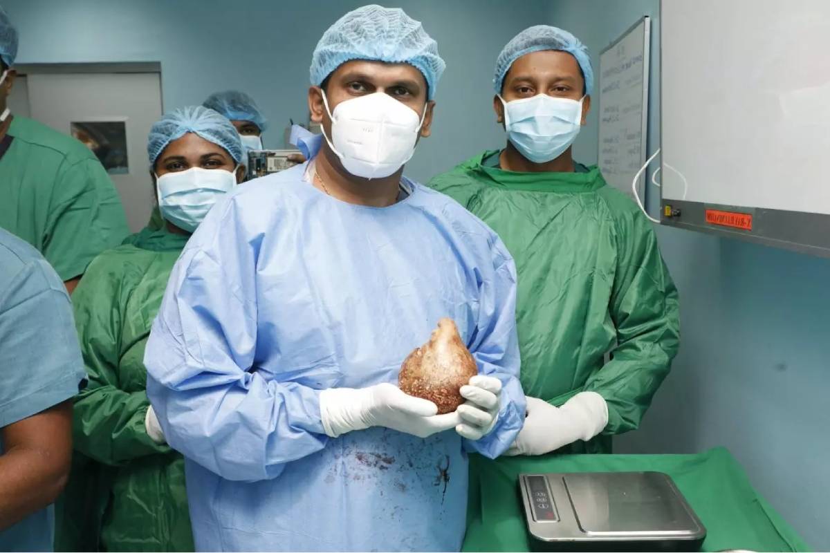 உலகின் மிகப்பெரிய சிறுநீரக கல்லை அகற்றி இலங்கை மருத்துவர்கள் சாதனை | Sri Lanka Doctor Removed 3 1Kg Kidney Stone Record