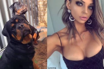 அழகிய இளம்பெண்ணை கடித்துக் குதறிய செல்லப்பிராணிகள்! பாக்டீரியா தொற்று ஏற்பட்டு பரிதாபம்