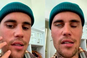 ஜஸ்டின் பீபருக்கு வந்த நோய்! முகத்தின் ஒரு பக்கம் அசையவில்லை