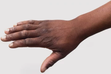 கருமையான கைகளை வீட்டிலேயே வெள்ளையாக மாற்றுவது எப்படி?