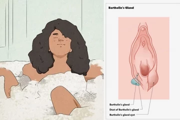 කාන්තාවන්ටම විශේෂිත වූ බාතෝලියන් ඇබ්සිස් රෝගය ගැන ඔබ දැනුවත්ද?