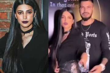 வாய் இப்படி கோணுது? நடிகை ஸ்ருதி ஹாசன் வெளியிட்ட புகைப்படங்கள்..