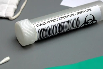 சுவிட்சர்லாந்தில் கொரோனா பரிசோதனை தொடர்பில் வெளியிடப்பட்டுள்ள அறிவிப்பால் குழப்பம்