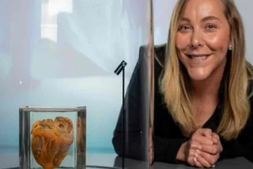 தன் இதயத்தை தானே பார்த்து வியந்து போன பெண்! பிரித்தானியாவில் சுவாரசியமான சம்பவம்