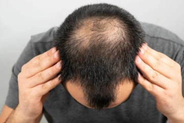 முடி கொத்து கொத்த கொட்டுதா? இந்த உணவுகளை சாப்பிடுங்க...காடு மாதிரி அடர்த்தியா முடி வளரும்!