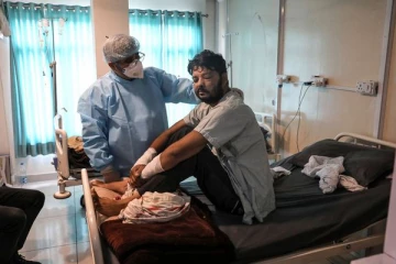 உலக நாடுகளில் பீதியை கிளப்பும் ஆபத்தான கருப்பு பூஞ்சை பாதிப்பு: கண்களை இழந்த பலர்