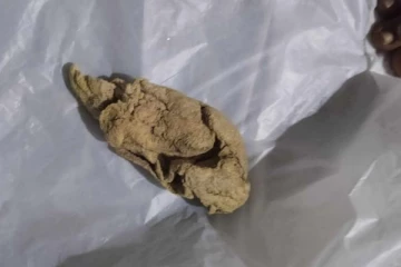 மட்டக்களப்பில் வைத்தியர்களின் அஜாக்கிரதை - உயிர் தப்பிய பெண்