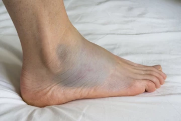 அடிக்கடி பாதங்கள் வீங்குவது ஏன் ? இதற்கு என்ன காரணம்?