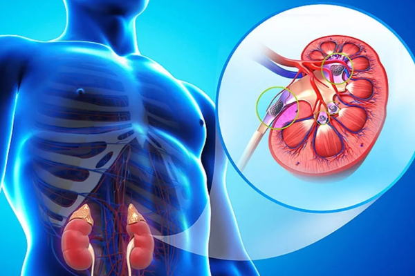 நாட்டில் வயதிற்கு வந்த 10 பேரில் ஒருவருக்கு இந்த நோய் | Kidney Disease Patients Increased In The Country