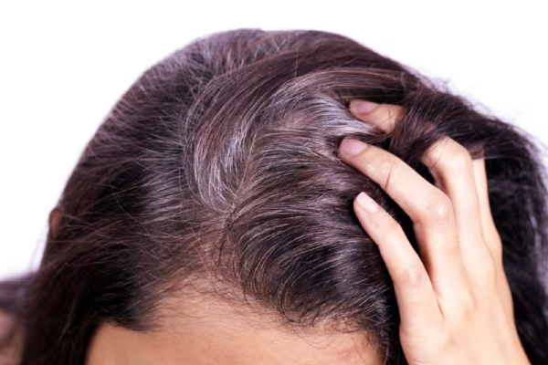 தலையில் இருக்கும் ஒரு நரைமுடியை பிடிங்கினால் மற்ற முடிகளுக்கு என்னாகும்? | Pluck One Grey Hair From Your Head What Happens தலையில் இருக்கும் ஒரு நரைமுடியை பிடிங்கினால் மற்ற முடிகளுக்கு என்னாகும்? | Pluck One Grey Hair From Your Head What Happens