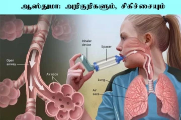 ஆஸ்துமாவின் அறிகுறிகள் என்ன? கட்டுப்படுத்த என்ன செய்யலாம்?
