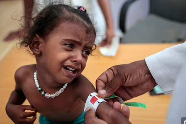 கொரோனாவை விட உலகில் இதனால் இறப்பவர்கள்தான் அதிகம்: அதிர்ச்சியளிக்கும் அறிக்கை | Deaths Due To This In The World Than In The Corona