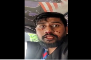 மகிந்த ஆதரவு ஆர்ப்பாட்டகாரர்களின் மோசமான தாக்குதல்: காயமடைந்த நபர்