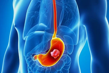 ஆபத்தான வயிற்று புற்றுநோயை எதிர்த்து போராட நீங்க தினமும் சமையலில் யூஸ் பண்ணும் இந்த பொருள் போதுமாம்!