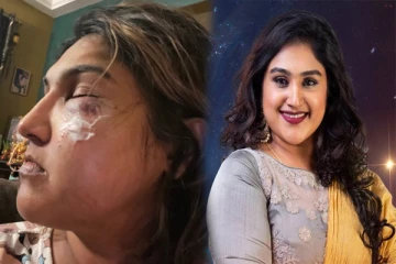 வனிதாவை தாக்கிய பிரதீப் ஆண்டனி ஆதரவாளர்: ரத்த காயங்களுடன் வெளியான போட்டோ