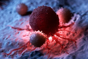 පිළිකා (Cancer) ඇති වීමට බලපාන හේතු.