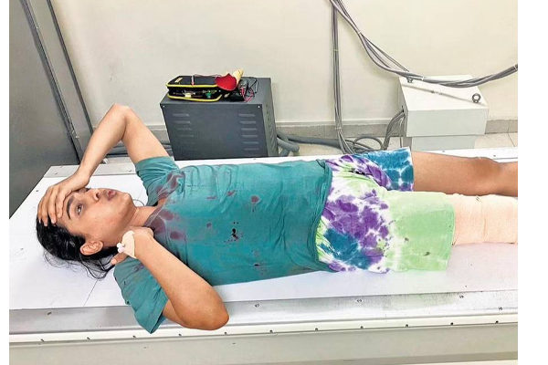 கோமாளி பட நடிகைக்கு விபத்து... படுகாயத்துடன் மருத்துவமனையில் அனுமதி! | Actress Samyuktha Hegde Injured